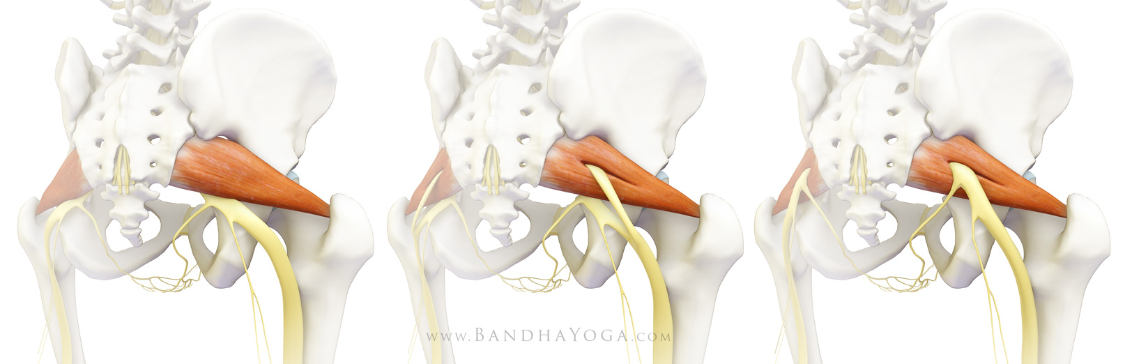 Грушевидная Piriformis